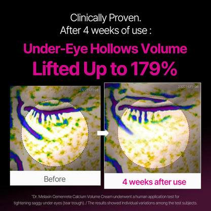 Calcium Volume Multi Balm & Eye Patch 60ea [TikTok Bestseller]
