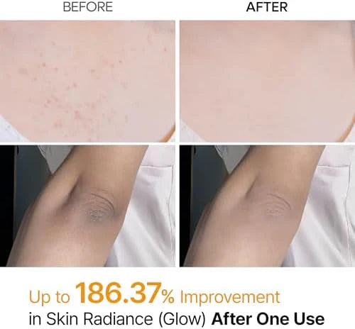 Glass surface Renewal Kit (6 Pcs) [TikTok Bestseller]